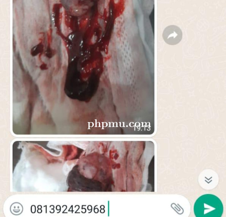 Jual Obat Aborsi SAMARINDA (Ampuh100%) 081392425968 Klinik Jual Obat Penggugur Kandungan Di SAMARIND